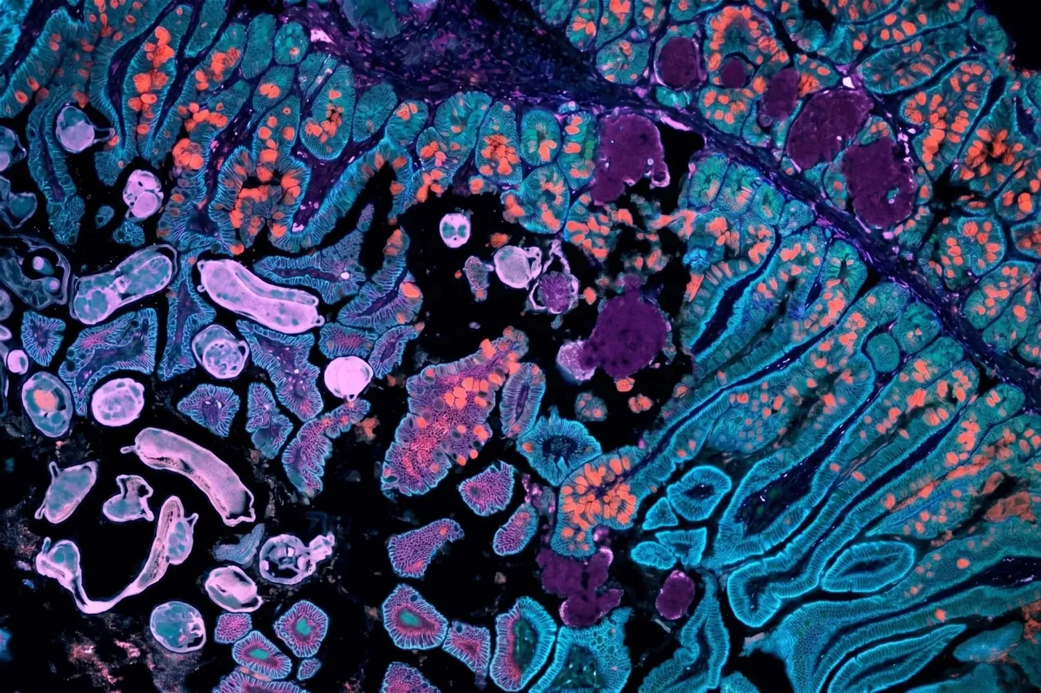 Fluorescence micrograph of a tissue section, glands and cell nuclei picked out in cyan, magenta and orange.